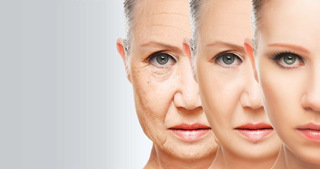 Подмладяване на кожата на лицето с лазерна технология